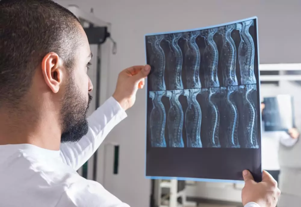 Stockton Spinal Cord Injury Lawyers